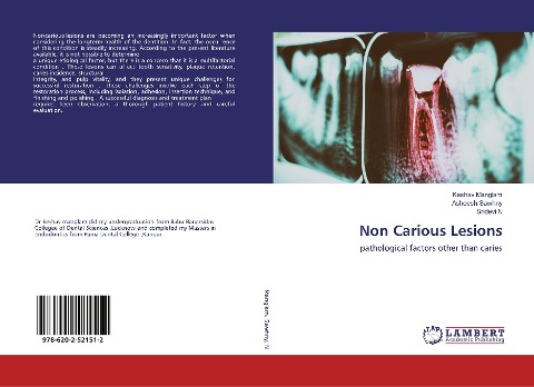 Non Carious Lesions: pathological factors other than caries