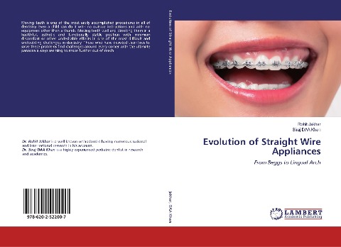 Evolution of Straight Wire Appliances: From Beggs to Lingual Arch