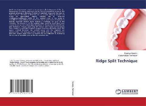 Ridge Split Technique
