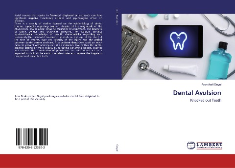 Dental Avulsion: Knocked out Teeth