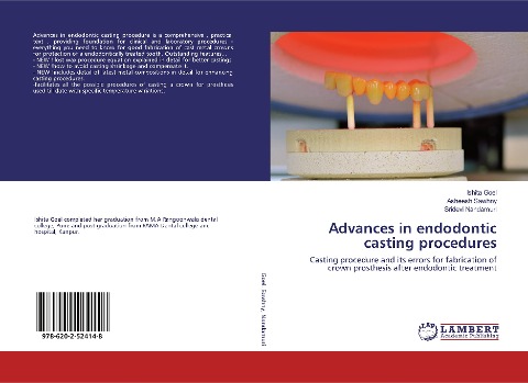 Advances in endodontic casting procedures: Casting procedure and its errors for fabrication of crown prosthesis after endodontic treatment