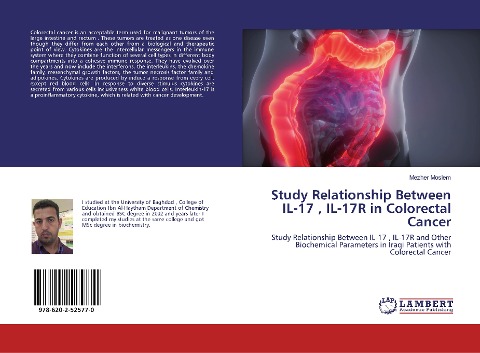 Study Relationship Between IL-17 , IL-17R in Colorectal Cancer: Study Relationship Between IL-17 , IL-17R and Other Biochemical Parameters in Iraqi Patients with Colorectal Cancer