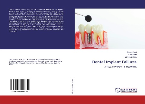 Dental Implant Failures: Causes, Prevention & Treatment