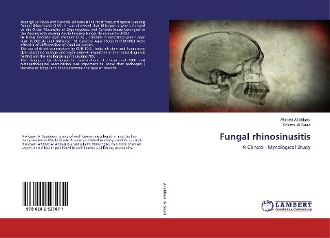 Fungal rhinosinusitis: A Clinico - Mycological Study
