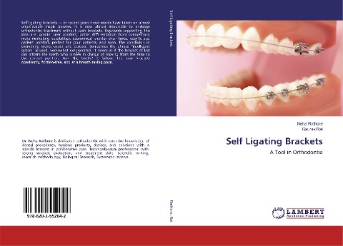 Self Ligating Brackets: A Tool in Orthodontia