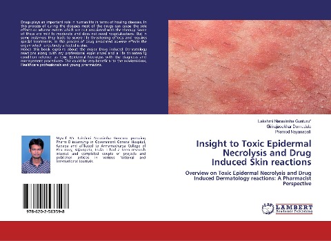 Insight to Toxic Epidermal Necrolysis and Drug Induced Skin reactions: Overview on Toxic Epidermal Necrolysis and Drug Induced Dermatology reactions: A Pharmacist Perspective