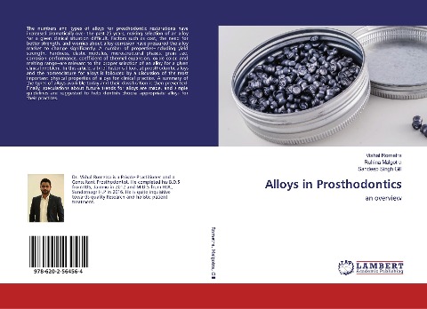 Alloys in Prosthodontics: an overview