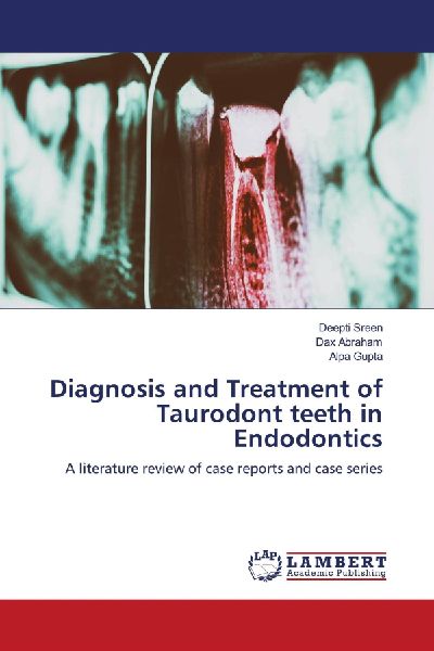 Diagnosis and Treatment of Taurodont teeth in Endodontics: A literature review of case reports and case series
