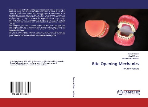Bite Opening Mechanics: In Orthodontics