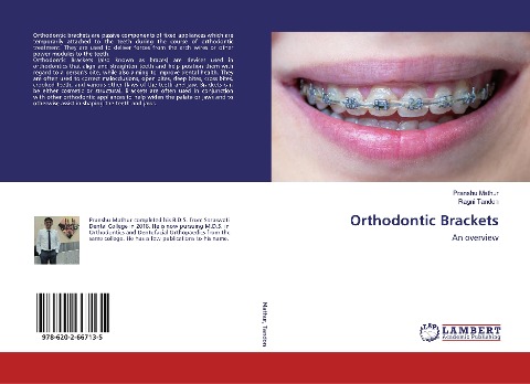 Orthodontic Brackets: An overview