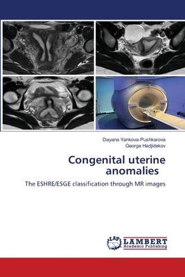 Congenital uterine anomalies: The ESHRE/ESGE classification through MR images