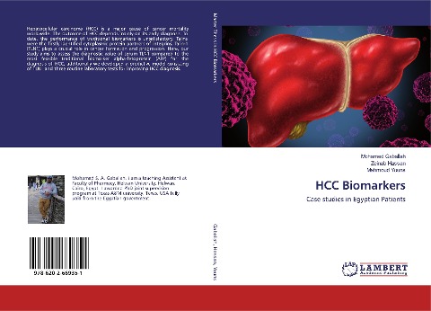 HCC Biomarkers: Case studies in Egyptian Patients