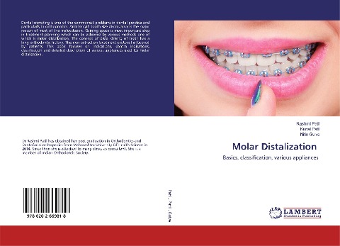 Molar Distalization: Basics, classification, various appliances