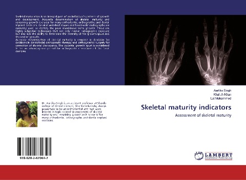 Skeletal maturity indicators: Assessment of skeletal maturity