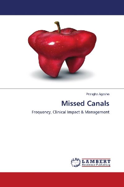 Missed Canals: Frequency, Clinical Impact & Management