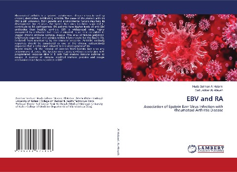 EBV and RA: Association of Epstein Barr Virus Infection with Rheumatoid Arthritis Disease