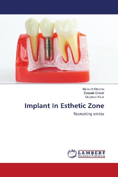 Implant In Esthetic Zone: Recreating smiles