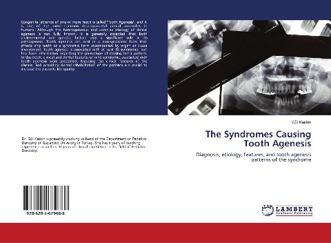 The Syndromes Causing Tooth Agenesis: Diagnosis, etiology, features, and tooth agenesis patterns of the syndrome