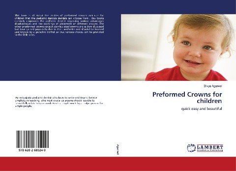 Preformed Crowns for children: quick easy and beautiful