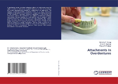 Attachments In Overdentures