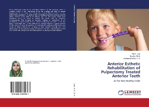 Anterior Esthetic Rehabilitation of Pulpectomy Treated Anterior Teeth: All for Kids Healthy Smile
