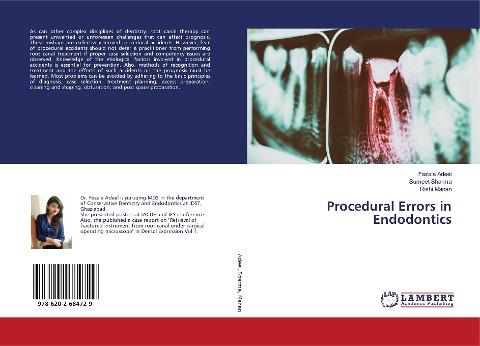Procedural Errors in Endodontics