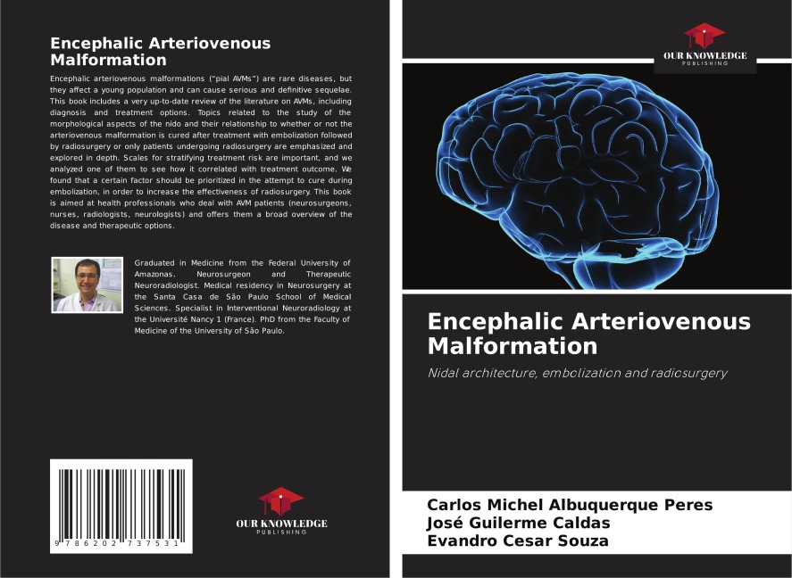 Encephalic Arteriovenous Malformation: Nidal architecture, embolization and radiosurgery