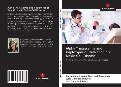 Alpha Thalassemia and Haplotypes of Beta Globin in Sickle Cell Disease: Genetic analysis and cerebral vascular disease