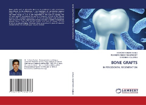 BONE GRAFTS: IN PERIODONTAL REGENERATION