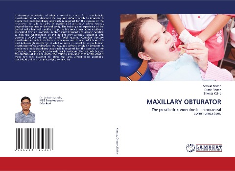 MAXILLARY OBTURATOR: The prosthetic connection in an oroantral communication.