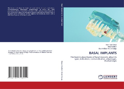 BASAL IMPLANTS: This book is about basics of basal implants; about its types, indications, contraindication, advantages, disadvantages