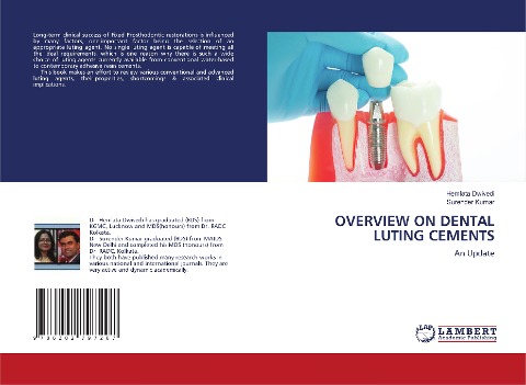 OVERVIEW ON DENTAL LUTING CEMENTS: An Update