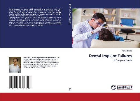 Dental Implant Failures: A Complete Guide