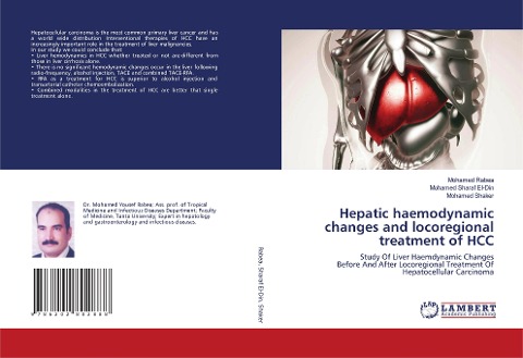 Hepatic haemodynamic changes and locoregional treatment of HCC: Study Of Liver Haemdynamic ChangesBefore And After Locoregional Treatment OfHepatocellular Carcinoma