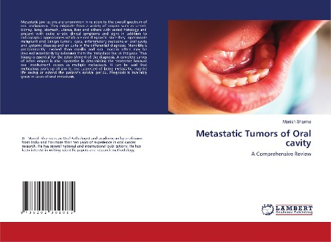 Metastatic Tumors of Oral cavity: A Comprehensive Review