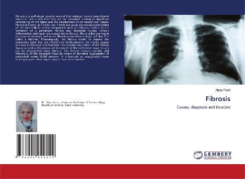 Fibrosis: Causes, diagnosis and location