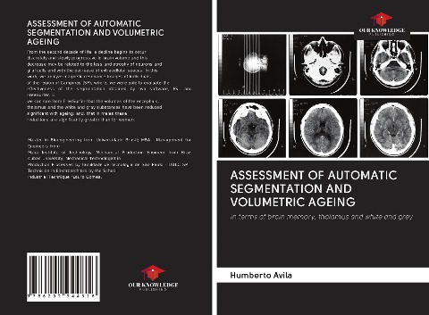 ASSESSMENT OF AUTOMATIC SEGMENTATION AND VOLUMETRIC AGEING: in terms of brain memory, thalamus and white and grey
