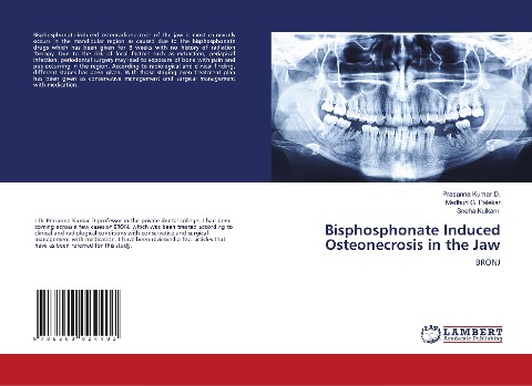 Bisphosphonate Induced Osteonecrosis in the Jaw: BRONJ