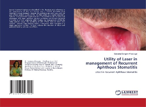 Utility of Laser in management of Recurrent Aphthous Stomatitis: LASER in Recurrent Aphthous Stomatitis