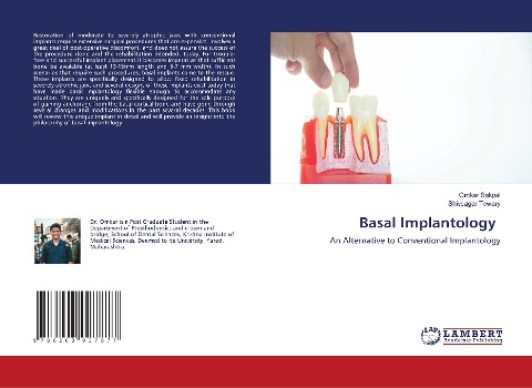 Basal Implantology: An Alternative to Conventional Implantology