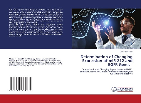 Determination of Changing Expression of miR-212 and EGFR Genes: Determination of Changing Expression of miR-212 and EGFR Genes in Clinical Samples of Trichophyton rubrum dermatophyte
