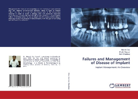 Failures and Management of Disease of Implant: Implant Management: An Overview