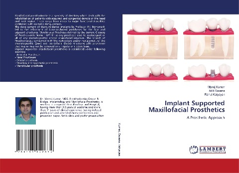 Implant Supported Maxillofacial Prosthetics: A Prosthetic Approach