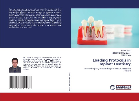Loading Protocols in Implant Dentistry: Learn the past, Watch the present & Create the future
