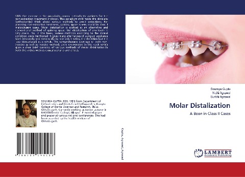 Molar Distalization: A Boon in Class II Cases