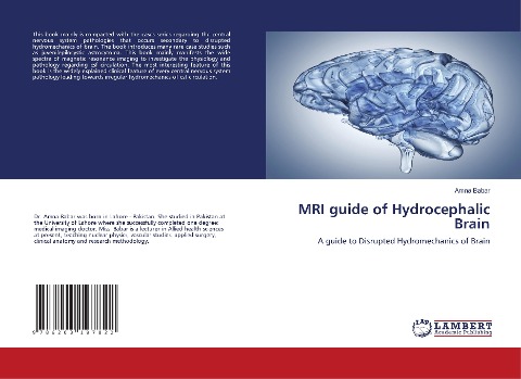 MRI guide of Hydrocephalic Brain: A guide to Disrupted Hydromechanics of Brain