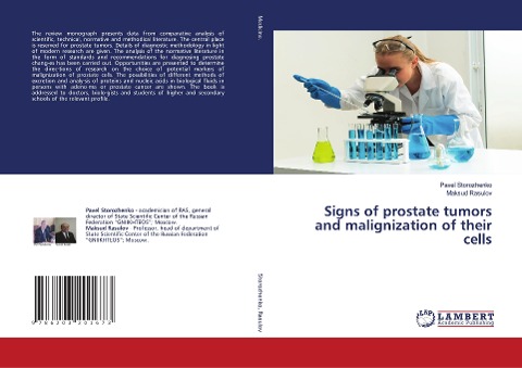 Signs of prostate tumors and malignization of their cells
