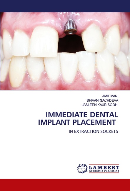 IMMEDIATE DENTAL IMPLANT PLACEMENT: IN EXTRACTION SOCKETS