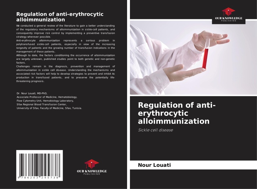 Regulation of anti-erythrocytic alloimmunization: Sickle cell disease