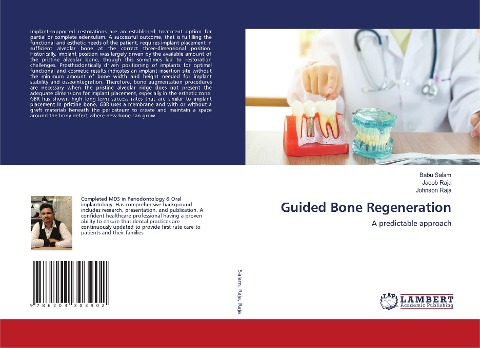 Guided Bone Regeneration: A predictable approach